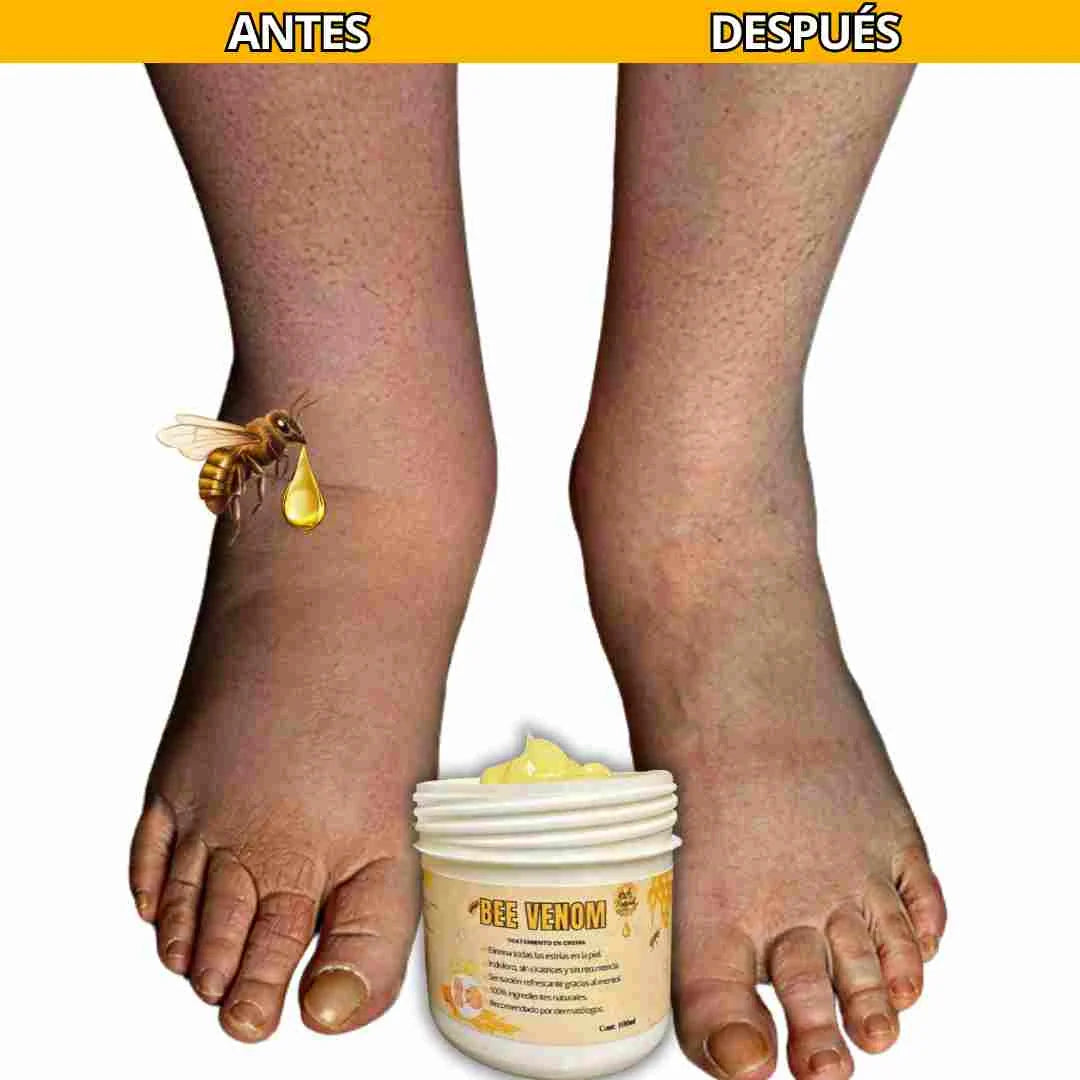 Bee Venom - Luce una piel más firme y radiante